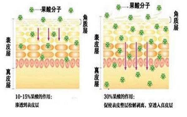 果酸换肤后怎么护理