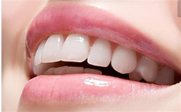 牙颌畸形什么时候矫正比较好
