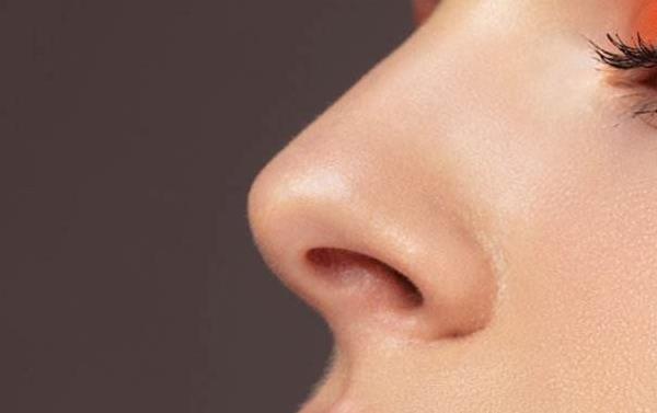 隆鼻透明质酸保持多长时间