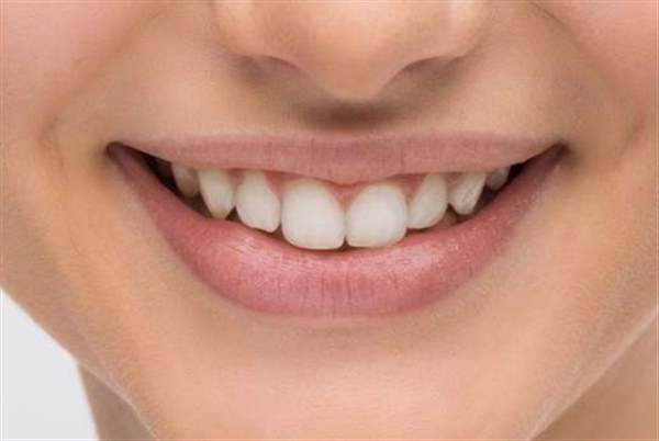 牙齿冷光美白有副作用吗