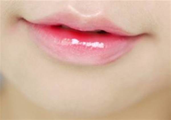唇部整形手术的注意事项有哪些